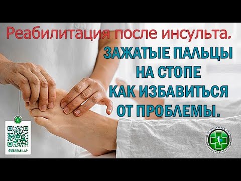 Видео: Реабилитация после инсульта. Зажатые пальцы на стопе парализованной  ноги. Что делать, как исправить