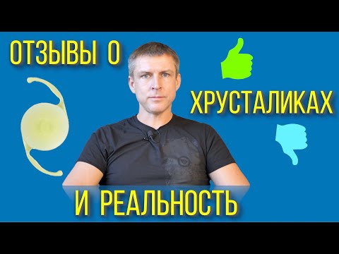 Видео: Отзывы о хрусталиках глаза и реальность лечения катаракты