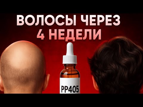 Видео: PP405 спасёт от облысения или нет?