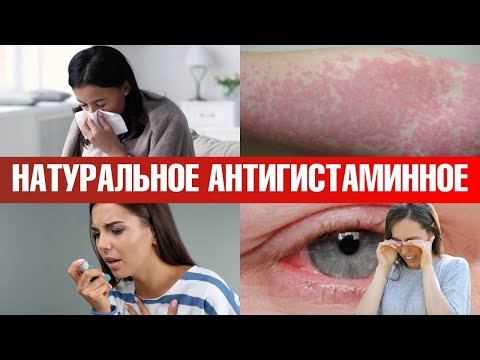 Видео: Лучшее антигистаминное средство. Натуральный Зиртек👌