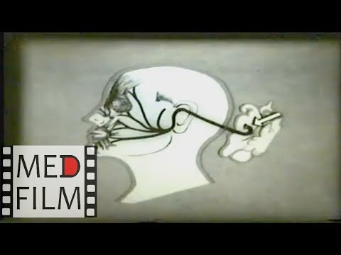 Видео: Синдромы поражения двигательных черепных нервов © Syndromes destruction of motor cranial nerves