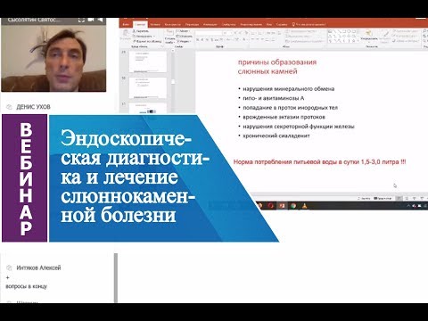 Видео: Вебинар Эндоскопическая диагностика и лечение слюннокаменной болезни
