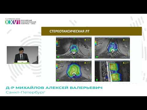 Видео: Стереотаксическая лучевая терапия при костных метастазах