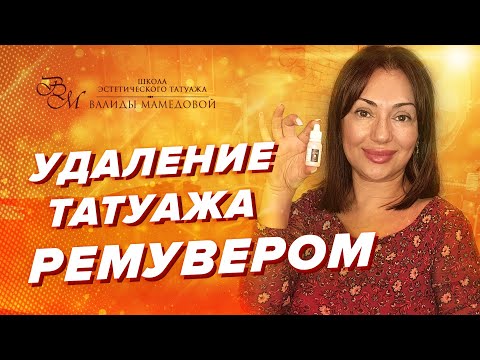 Видео: Удаление татуажа ремувером. Мнение Валиды Мамедовой