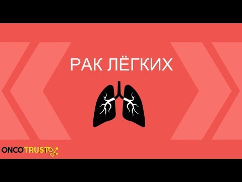 Видео: Симптомы и лечение рака легких - Prof Dr Mustafa Ozdogan