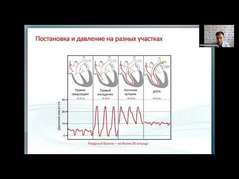 Видео: Инвазивный мониторинг центральной гемодинамики Омаров Ю.А.