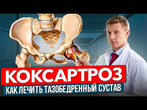 Видео: ЛЕЧЕНИЕ КОКСАРТРОЗА | Доктор Еремин Иван Константинович