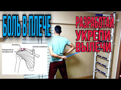 Видео: Плече-лопаточный периартирит - Лечение патологий плеча