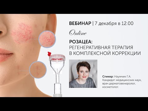 Видео: РОЗАЦЕА Регенеративная терапия в комплексной коррекции