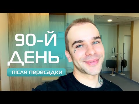 Видео: Через 3 місяці після пересадки волосся – я в шоці від результату!!! 😱