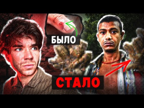 Видео: ВИРУС, который сделал с ним ЭТО. Почему? | РазМИШления.