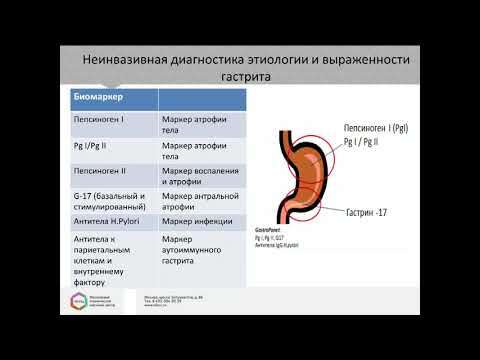 Видео: Круглый стол «Атрофический гастрит, МАLT-лимфома и НЭО желудка – междисциплинарный подход»