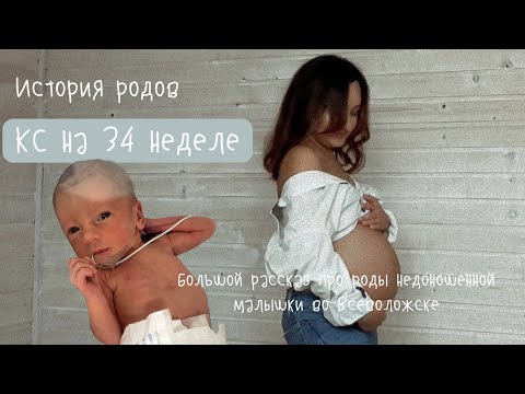 Видео: ИСТОРИЯ РОДОВ 🤰🏽 Кесарево сечение на 34 неделе. Недоношенный ребенок. Роддом г. Всеволожск