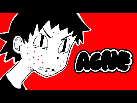 Видео: АКНЕ