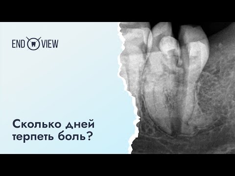 Видео: Боль после удаления зуба - что делать?
