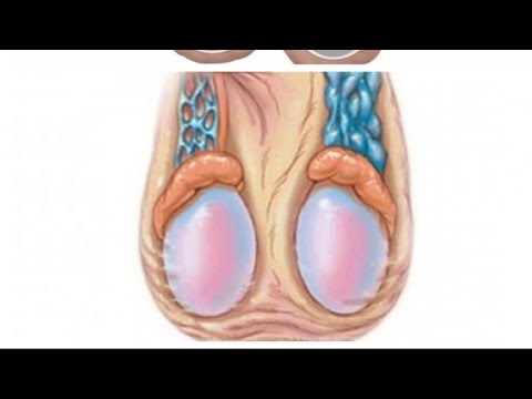 Видео: Варикацеле, чи кор кунем пешгири кунем☎️ +79969800352