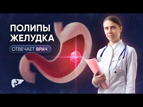 Видео: Полипы желудка: причины, диагностика и лечение
