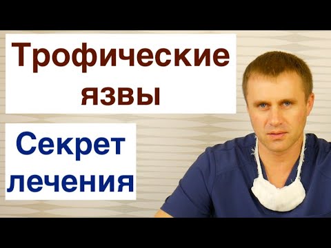 Видео: Трофические язвы. Секрет лечения.