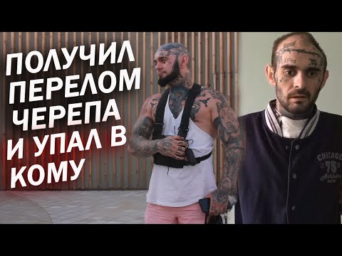 Видео: Мое моноколесо отключилось на большой скорости. Получил перелом черепа