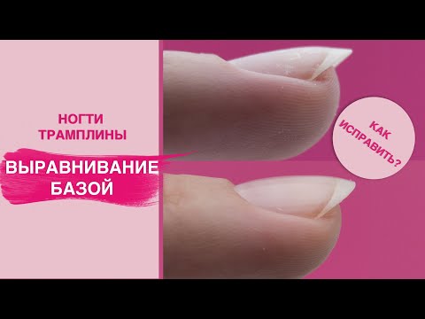 Видео: ВЫРАВНИВАНИЕ НОГТЕВОЙ пластины базой. Исправление трамплинообразных ногтей!