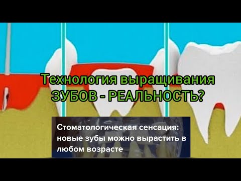 Видео: Начало выращивание зуба.