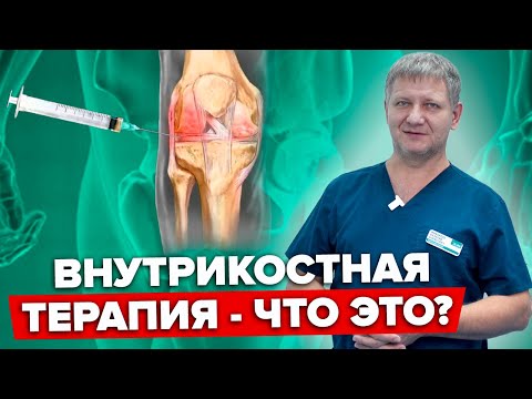 Видео: Что Такое Внутрикостная Терапия? Особенности Внутрикостной Терапии