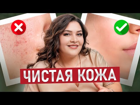 Видео: Вы НАВСЕГДА забудете про АКНЕ! / Как УХАЖИВАТЬ за проблемной кожей?