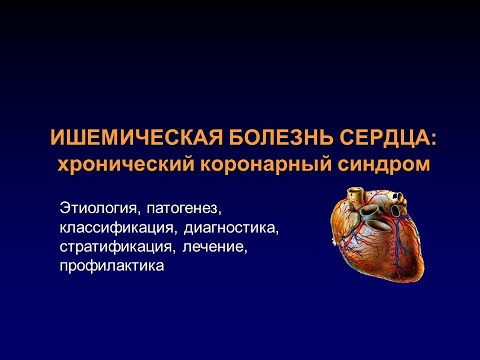 Видео: Хронический коронарный синдром