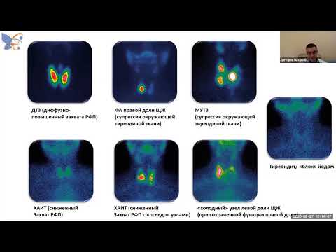 Видео: Молекулярная визуализация в эндокринологии и онкоэндокринологии