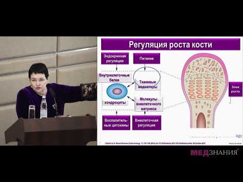 Видео: 12. Нарушения роста глазами педиатра