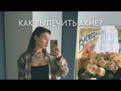 Видео: ЛЕЧЕНИЕ АКНЕ — МОЙ ОПЫТ | СИСТЕМНЫЕ РЕТИНОИДЫ