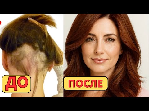 Видео: Волосы растут как на ДРОЖЖАХ и стали в 3 раза ГУЩЕ! Это самый МОЩНЫЙ способ!