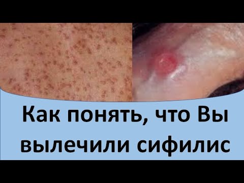 Видео: Как понять, что Вы вылечили сифилис