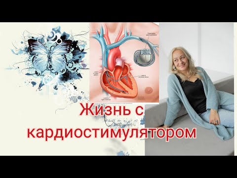 Видео: Жизнь с кардиостимулятором