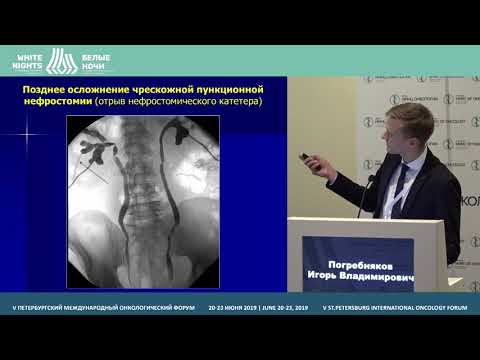Видео: Интервенционно- радиологические вмешательства в онкоурологии (Погребняков И.В.)