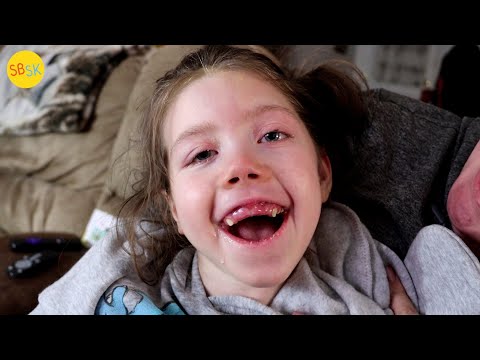 Видео: Мозг, поврежденный поцелуем (Опасность поцелуя ребенка)