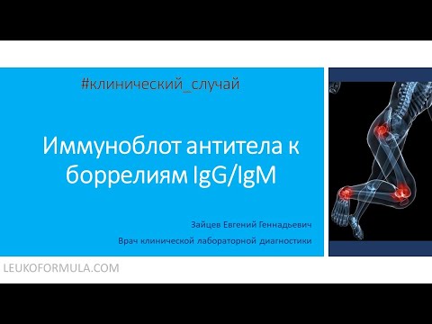 Видео: 3. Иммуноблот антител к боррелиям (Borrelia, IgM и Borrelia, IgG). Интерпретация.