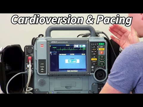 Видео: Lifepak 15 Часть 3: Электрокардиостимуляция и кардиоверсия