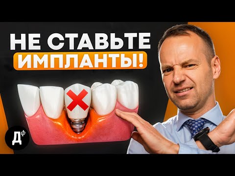 Видео: Кому НЕЛЬЗЯ ставить ИМПЛАНТЫ? Стоматологи не говорят об этом!
