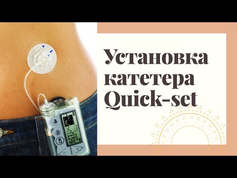 Видео: Как установить Квик-Сет? Обзор и заправка системы Quick-Set