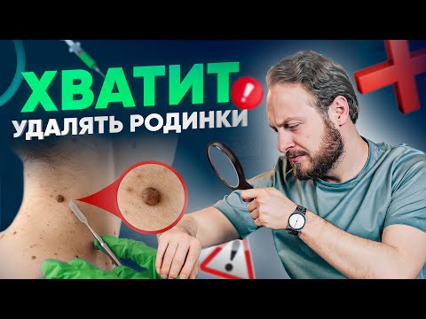Видео: Родинки и онкология – есть ли связь? Ответ тебя удивит