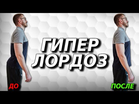 Видео: Простой и эффективный комплекс упражнений при поясничном гиперлордозе.