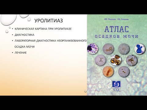 Видео: Уролитиаз
