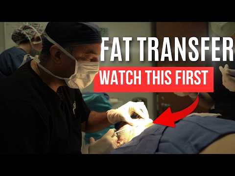 Видео: Пересадка жира на лицо и как это работает | Всё, что вам нужно знать о пересадке жира