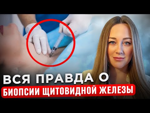 Видео: УДАЛЯТЬ ЩИТОВИДНУЮ ЖЕЛЕЗУ ИЛИ НЕТ? Как оценить результаты пункции? Есть ли осложнения?