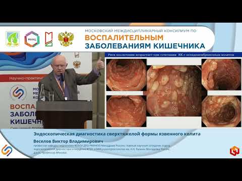 Видео: Веселов В.В. Эндоскопическая диагностика сверхтяжелой формы язвенного колита