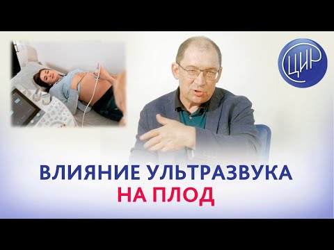 Видео: УЗИ в 1 триместре беременности. Сколько можно делать УЗИ? Как влияет ультразвук на беременность?