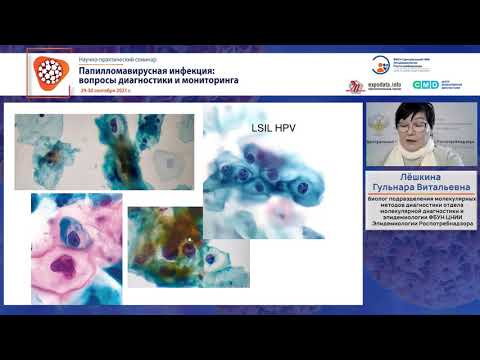 Видео: Сложные случаи диагностики ВПЧ-инфекции: опыт врача-цитолога