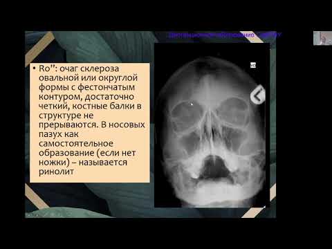 Видео: Опухоли костей. Лектор Е.К. Крамм