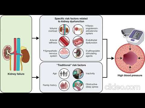 Видео: Подбор гипотензивных препаратов при гемодиализе: Сравнение рисков падения давления (ИДГ)